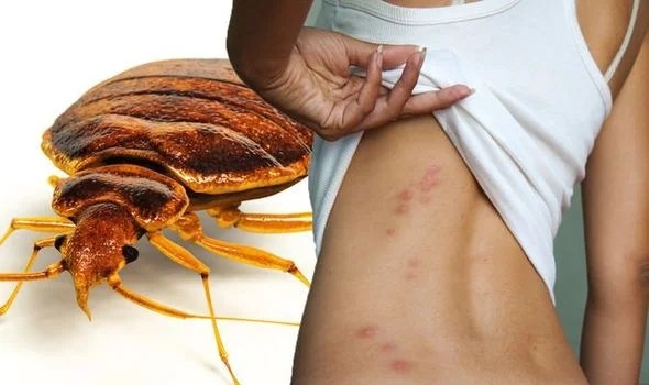 Everything You Need to Know About Bed&nbsp;Bugs